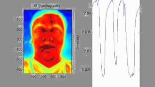 Contactless respiration measurement [upl. by Irahk]