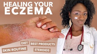 How to Treat ECZEMAAtopic Dermatitis Black Dark Skin Dry Flaky Skincare Routine Hyperpigmentation [upl. by Ahsircal454]