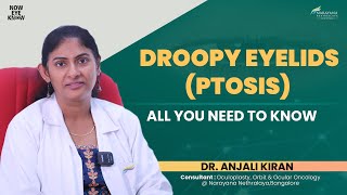 Droopy Eyelids Ptosis Explained  Dr Anjali Kiran  English [upl. by Natehc]