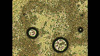 High level of partial coalescence in ice cream from JAOCS article [upl. by Paget565]