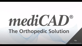 mediCAD Hip  Intertrochanteric Osteotomy [upl. by Spiers]