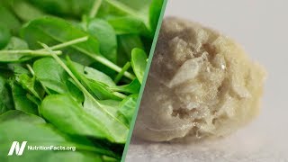 Oxalates in Spinach and Kidney Stones Should We Be Concerned [upl. by Irrem510]