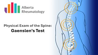 Rheumatology BACK exam Gaenslens Test [upl. by Semmes]