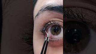 eye fishing 🎣 eye mucus removal eyes [upl. by Harshman]