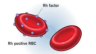 Rh Negative Pregnancy [upl. by Oj]