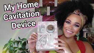 Home Laser Lipo  Ultrasound Cavitation Device Review Melts Fat [upl. by Sitrik516]