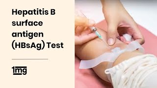 Hepatitis B surface antigen HBsAg Test  1mg [upl. by Nnednarb976]