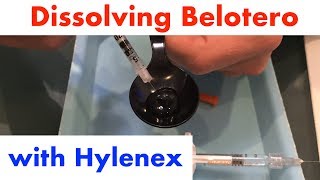 Dissolving Belotero with Hylenex Demo amp Discussion by Dr Steven F Weiner [upl. by Aiht]