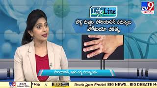 Psoriasis Skin problems  Homeopathic Treatment  Lifeline  TV9 [upl. by Wymore786]