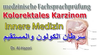 Kolonkarzinom  Chirurgie  Deutsch MD für Mediziner سرطان الكولون [upl. by Lisa320]