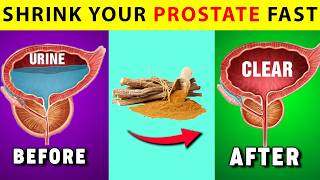 Doctors Don’t Want You to Know About These ProstateShrinking Herbs  Herbs to Shrink Prostate [upl. by Ihcehcu]