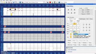 Charting Furcations and Mobility in Dentrix [upl. by Nnaeirb]