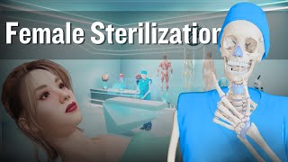 Female Sterilization Tubal Ligation Procedure  Tubectomy 3D Animation [upl. by Valtin]