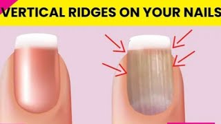 Don’t Ignore if Vertical Ridges on Your Nailsnails ai nailsinstagram Nails [upl. by Winny965]