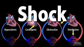 Shock Pathology of Different Types Animation [upl. by Siravart]