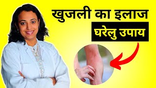 Itchy Skin Treatment in Hindi  Home Remedies [upl. by Karissa]