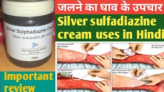 silver sulfadiazine cream uses in Hindi  Cream Side Effects  जलने का घाव के उपचार  Burnfree cr [upl. by Akineg290]