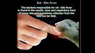 Rat Bite Fever  Everything You Need To Know  Dr Nabil Ebraheim [upl. by Ikaz]