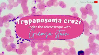 Trypanosoma cruzi under the microscope with Giemsa stain [upl. by Amikahs]