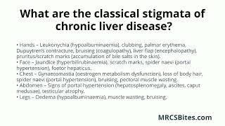 MRCS Part B What are the classical stigmata of chronic liver disease [upl. by Alithea]