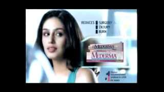 Mederma Scar Treatment  TVC  marks from stitches [upl. by Jacqueline518]