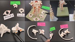 Vertebrae Anatomy  Cervical vs Thoracic vs Lumbar   Atlas vs Axis  Vertebral Column [upl. by Aiak]