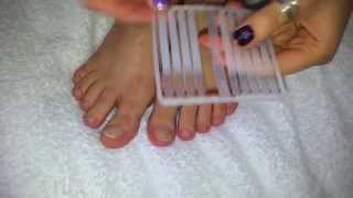 How to treat TOENAILS FUNGUS [upl. by Geoff]