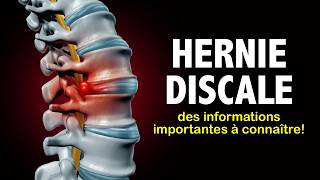 Hernie discale des informations importantes à connaître [upl. by Ellirpa]