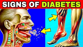 10 Unnoticed Symptoms of Diabetes [upl. by Haimes]