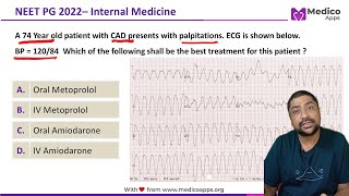 NEET PG Recall 2022 Sustained Monomorphic Ventricular Tachycardia Internal Medicine [upl. by Ernst]