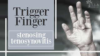 trigger finger and trigger thumb stenosing tenosynovitis [upl. by Nivac193]