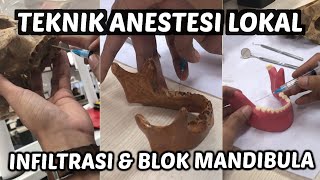 Praktikum teknik anestesi lokal Infiltrasi amp Blok Mandibula [upl. by Ailegra43]