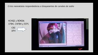 Tratamiento de las crisis convulsiones neonatales en encefalopatía hipóxico isquémica EHI [upl. by Josh]