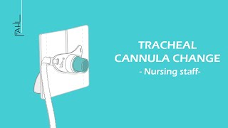 Tracheal cannula change for nursing staff  Animation  Fahl MedizintechnikVertrieb GmbH [upl. by Nallij]