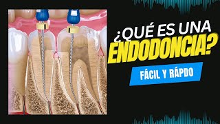 ¿Qué es una endodoncia dental Fácil y rápido [upl. by Hinze]