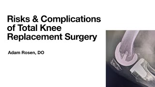 Risks and Complications and common expectations of Total Knee Replacement Surgery [upl. by Burl787]