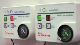 Sedação Leve com Óxido Nitroso Hospital Odontológico CIR Premier [upl. by Eednim]