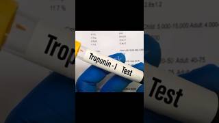 Mastering Cardiac Profiles Troponin Myoglobin and C Reactive Protein Levels medicaltest [upl. by Tubb]