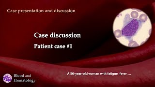 Patient case discussion case 1 [upl. by Halland]