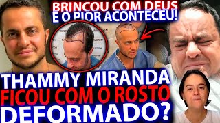 THAMMY MIRANDA BRINCA COM DEUS E FICA COM CARA TODA DEFORMADA MISERICORDIA O QUE É ISSO [upl. by Asset]