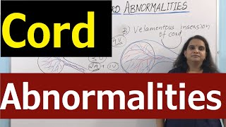 Umbilical Cord Abnormalities 🚺 Morphological variation of Cord 🚺 Nursing Lecture [upl. by Cleres307]