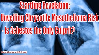 Chrysotile Mesothelioma Risk  Is Mesothelioma Always Caused by Asbestos Exposure [upl. by Rusty998]