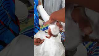 Long arm full plaster ourtreatment hand casting fracture shorts treatment [upl. by Corabelle759]