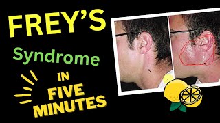 Freys Syndrome  In FIVE 5️⃣ 🕔 MINUTES [upl. by Annocahs]