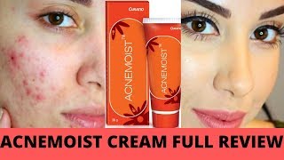 ACNEMOIST CREAM FULL REVIEW BEST CREAM FOR ACNE PRONE SKIN पिम्पल्स वाले लोगो के लिए बेस्ट क्रीम [upl. by Rodavlas780]