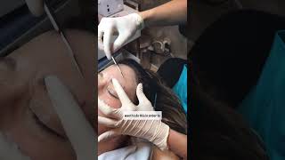 Esthetician Training Elevate your dermaplaning skills [upl. by Nosnibor]