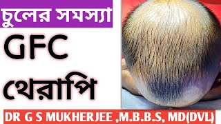 চুলের সমস্যা  Hair Fall Problem  Alopecia PRP Therapy Dr G S Mukherjee [upl. by Tower]