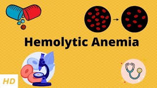 Hemolytic Anemias Part 3 HEREDITARY SPHEROCYTOSIS [upl. by Teresita]