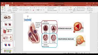 Valvulas cardiacas [upl. by Donohue]