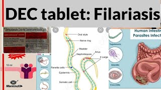 Drug For Filariasis DEC  Diethylcarbamazine and Antihistamine CPM [upl. by Eenahpets688]